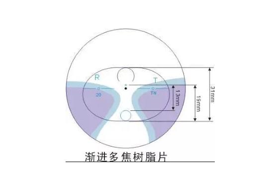 美麗島多焦鏡適合的人群，需要注意的事項